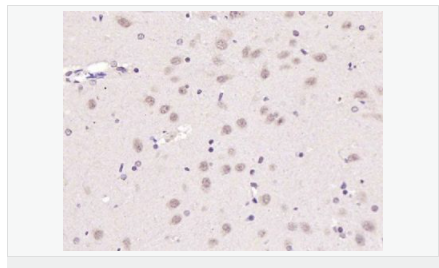 6058356fbd25d.png image.png