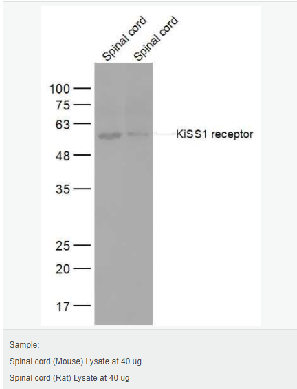 60594d6f185cc.png image.png