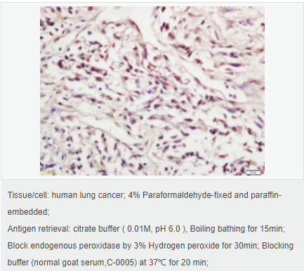 605957ec47bd7.png image.png