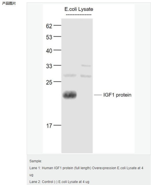 605da0efd2183.png image.png