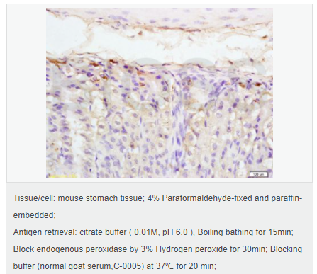 6076419309c98.png image.png